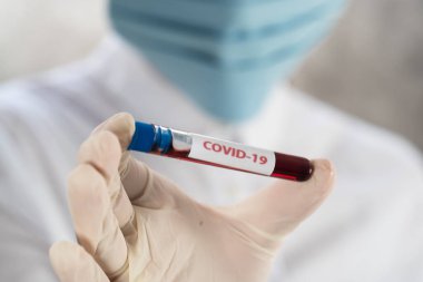 NCoV-2019 için kanla test tüpü tutan hemşire laboratuvarda Coronavirus testi konseptini analiz ediyor.