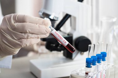 NCoV-2019 için kanla test tüpü tutan hemşire laboratuvarda Coronavirus testi konseptini analiz ediyor.