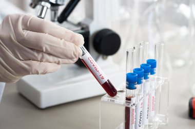 NCoV-2019 için kanla test tüpü tutan hemşire laboratuvarda Coronavirus testi konseptini analiz ediyor.