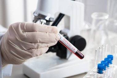 NCoV-2019 için kanla test tüpü tutan hemşire laboratuvarda Coronavirus testi konseptini analiz ediyor.