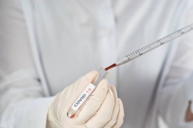 NCoV-2019 için kanla test tüpü tutan hemşire laboratuvarda Coronavirus testi konseptini analiz ediyor.