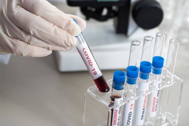NCoV-2019 için kanla test tüpü tutan hemşire laboratuvarda Coronavirus testi konseptini analiz ediyor.