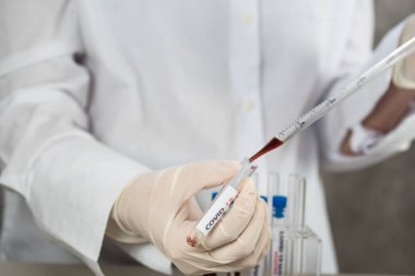 NCoV-2019 için kanla test tüpü tutan hemşire laboratuvarda Coronavirus testi konseptini analiz ediyor.