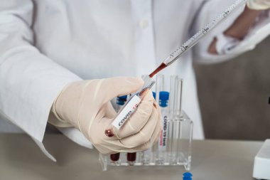 NCoV-2019 için kanla test tüpü tutan hemşire laboratuvarda Coronavirus testi konseptini analiz ediyor.