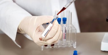 NCoV-2019 için kanla test tüpü tutan hemşire laboratuvarda Coronavirus testi konseptini analiz ediyor.