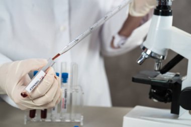NCoV-2019 için kanla test tüpü tutan hemşire laboratuvarda Coronavirus testi konseptini analiz ediyor.