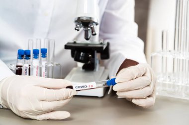 NCoV-2019 için kanla test tüpü tutan hemşire laboratuvarda Coronavirus testi konseptini analiz ediyor.