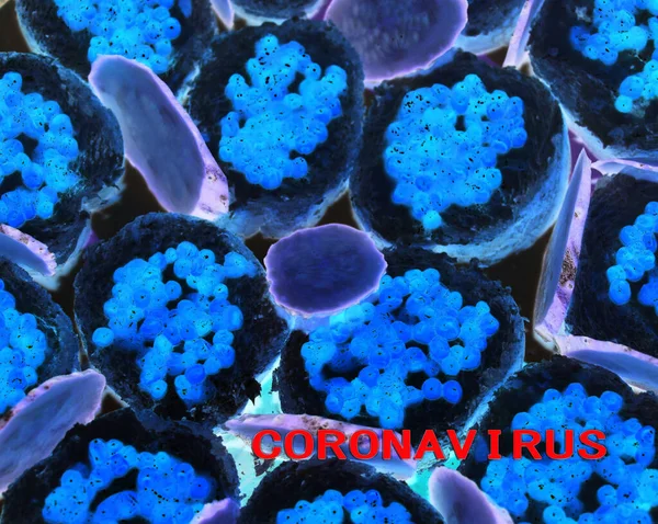 显微镜下的病毒蓝色的细菌性宏 致命的病毒有许多倍大 显微镜下的细菌 — 图库照片