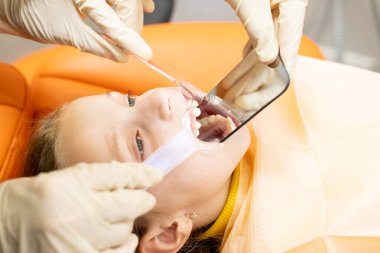 Diş bozuklukları, alt dişlerin arkasındaki üst dişler.