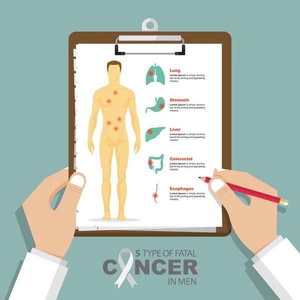 Infografía para los 5 tipos principales de cáncer mortal en hombres de diseño plano. Portapapeles en la mano del doctor. Informe médico y sanitario . — Vector de stock