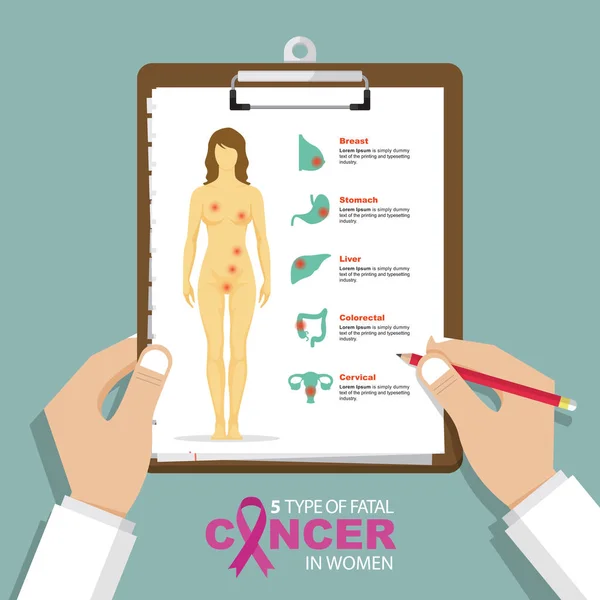 Infografía para los 5 tipos principales de cáncer mortal en mujeres de diseño plano. Portapapeles en la mano del doctor. Informe médico y sanitario . — Archivo Imágenes Vectoriales