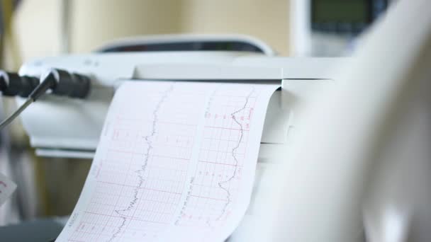 Máquina Monitor Pressão Arterial Hospital — Vídeo de Stock