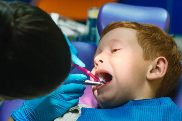 Ein verschreckter rothaariger Junge weint an der Rezeption beim Zahnarzt im Zahnarztstuhl. Kinderzahnheilkunde — Stockfoto