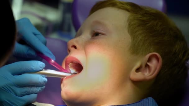Dentysta leczy zęby przestraszonego rudego chłopca. — Wideo stockowe