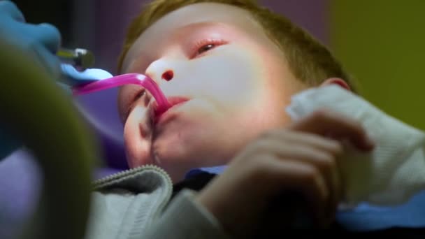 The dentist treats the teeth of a frightened redheaded boy — Stok video