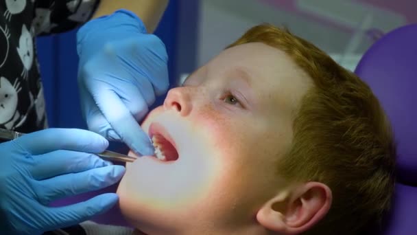 Muchacho pelirrojo asustado llorando en la recepción del dentista en la silla dental. Odontología pediátrica — Vídeos de Stock