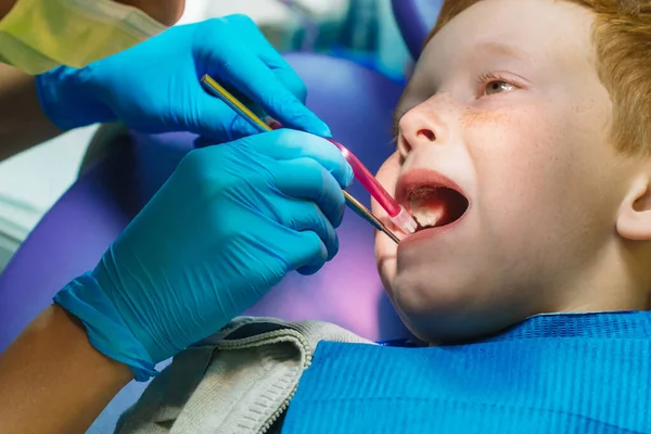 Ein verschreckter rothaariger Junge weint an der Rezeption beim Zahnarzt im Zahnarztstuhl. Kinderzahnheilkunde — Stockfoto