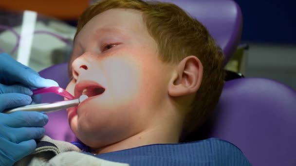 Przestraszony rudy chłopiec płaczący w recepcji u dentysty na krześle dentystycznym. Stomatologia dziecięca — Wideo stockowe
