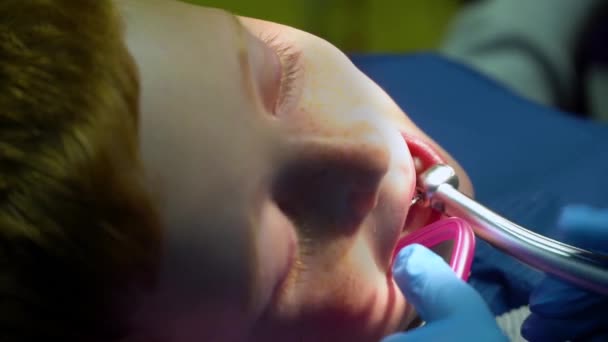 The dentist treats the teeth of a frightened redheaded boy — Stok video