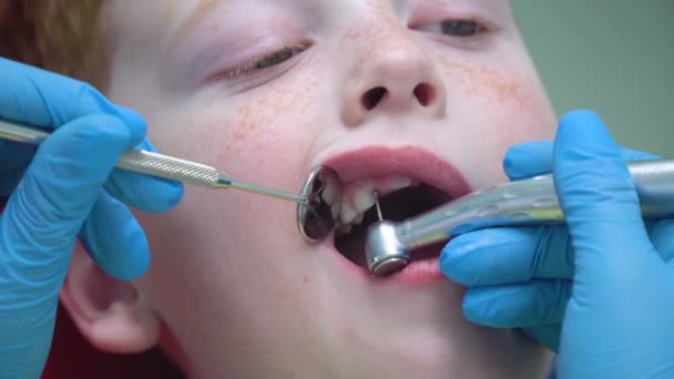 Close-up van vrouwelijke tandarts behandelen van kleine jongen in de tandheelkundige kliniek. Pediatrische tandheelkunde — Stockvideo