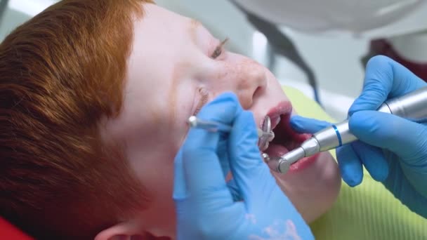 Il dentista esamina i denti da latte. Odontoiatria pediatrica — Video Stock