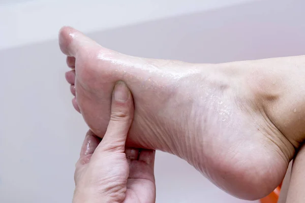 Antibacterial Honey Scrub Removing Dead Tissue Skin Your Feet — Stock Photo, Image