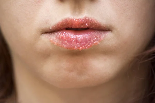 Strawberry lip scrub made at home to exfoliate lips