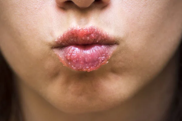 Strawberry lip scrub made at home to exfoliate lips