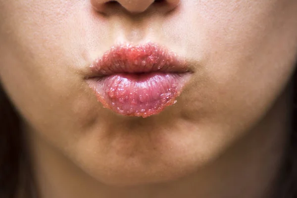 Exfoliante Labial Fresa Hecho Casa Para Exfoliar Los Labios — Foto de Stock