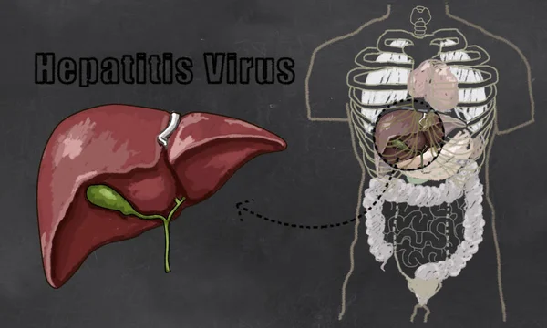 Hepatitis Disease Illustration — Stock Photo, Image