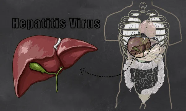 Hepatit hastalığı illüstrasyon