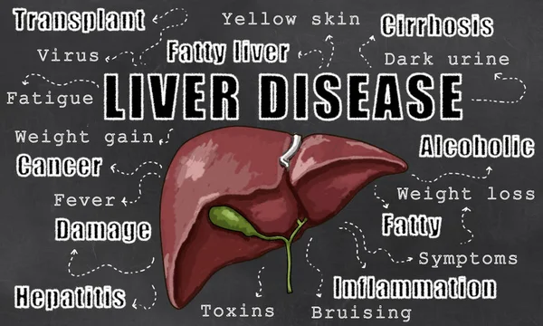 Illustratie van de leverziekte — Stockfoto