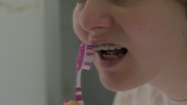 Girl brushing braces — Stock Video