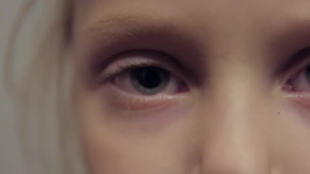 Дівчинка з болючими очима — стокове відео