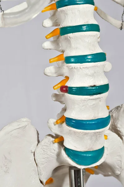 Mockup of human skeleton. Demonstration of diseases of the musculoskeletal system. Bones isolated on a white background. Lumbar spine and pelvis. Intervertebral hernia. — Stock Image Mockup Human Skeleton Demonstration Diseases Musculoskeletal System Bones Isolated White Royalty Free Stock Photos