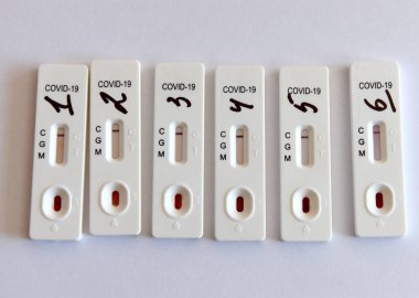 Lviv, Ukrayna - 31 Mart 2020: Coronavirus COVID-19 için Lviv 'deki yerel belediye kurumlarının çalışanları test edilirken yapılan hızlı testler. 