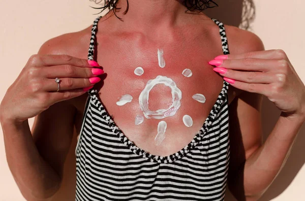 Pele de queimadura solar feminina — Fotografia de Stock