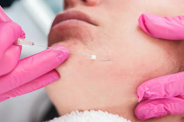 Primeros Planos Concepto Cosmetología Mujer Joven Recibiendo Inyección Debajo Barbilla — Foto de Stock