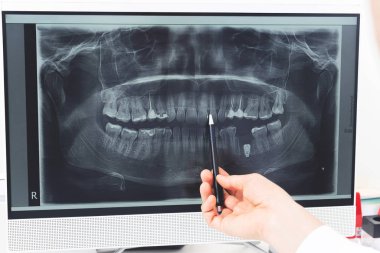 Kırpılmış doktorlar, insan çenesinin panoramik diş röntgenini çekiyorlar.