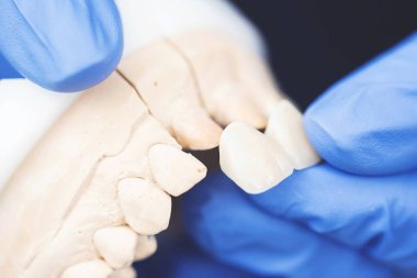 Dişçi elinde takma dişler tutuyor. Doktorun elinde diş protezi var.