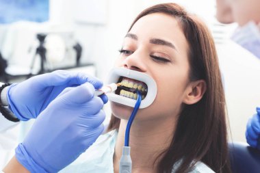 Diş beyazlatmak için fotopolimer kullanan genç bir kadının portresi. Kadın için diş beyazlatma. Dişçi kliniğinde dişlerin beyazlaması..