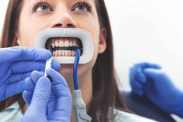 Dentistry Healthy Teeth Medicine Healthcare Concept Closeup Portrait Young Woman — ストック写真