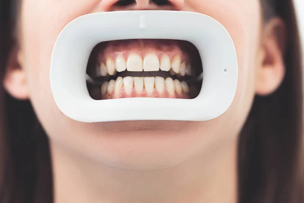 Dentistry Healthy Teeth Medicine Healthcare Concept Closeup Portrait Young Woman Stockfoto