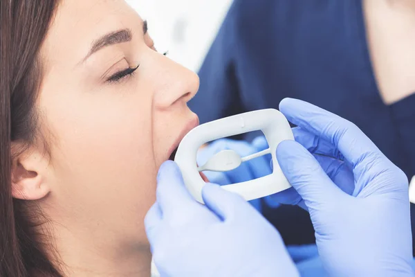 Close Portrait Female Patient Dentist Clinic Teeth Whitening Procedure Copy — Stockfoto