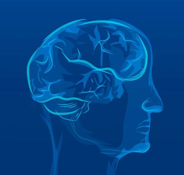 Schmerzen im Gehirn, Röntgen, Beleidigung, medizinische Vektorillustration — Stockvektor