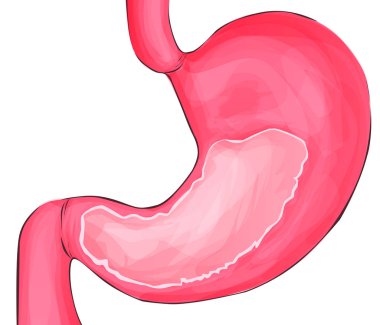 Mide boş. Çizgi film vektör tıp çizim. Karikatür tarzı