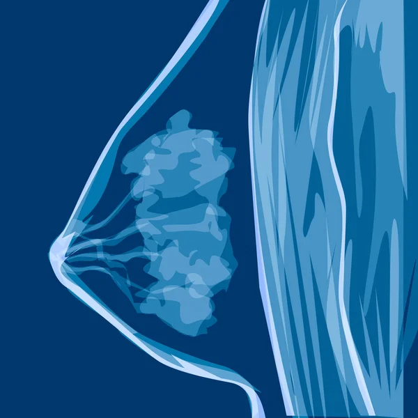 Woman Breast Anatomy. Vector medicine illustration, x-rays — Stock Vector