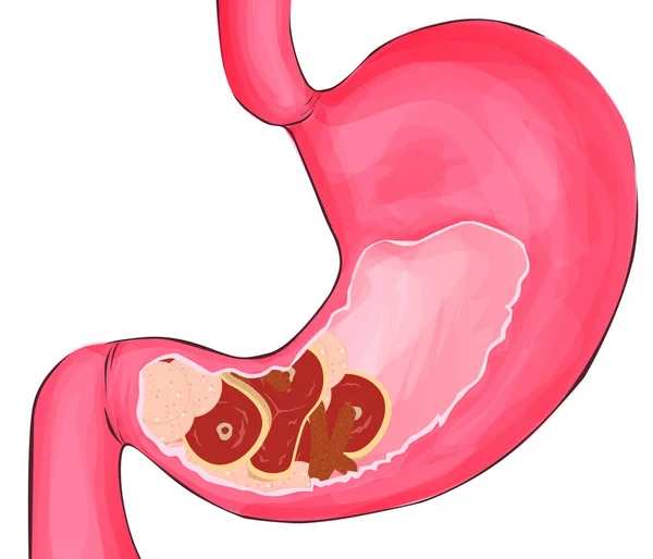 Fleisch im menschlichen Magen. Ernährung, gesunde Ernährung - Vektorillustration — Stockvektor