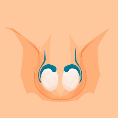 Vasectomy. Male organs, reproductive anatomy. Testicles Vector cartoon illustration clipart