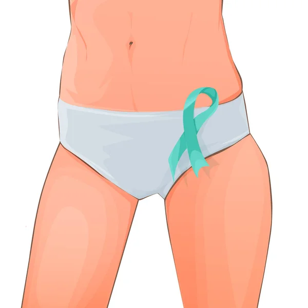 Vektorová Ilustrace Bavlněných Kalhotek Ženách Obrázek Ženské Onkologie Péče Heatl — Stockový vektor